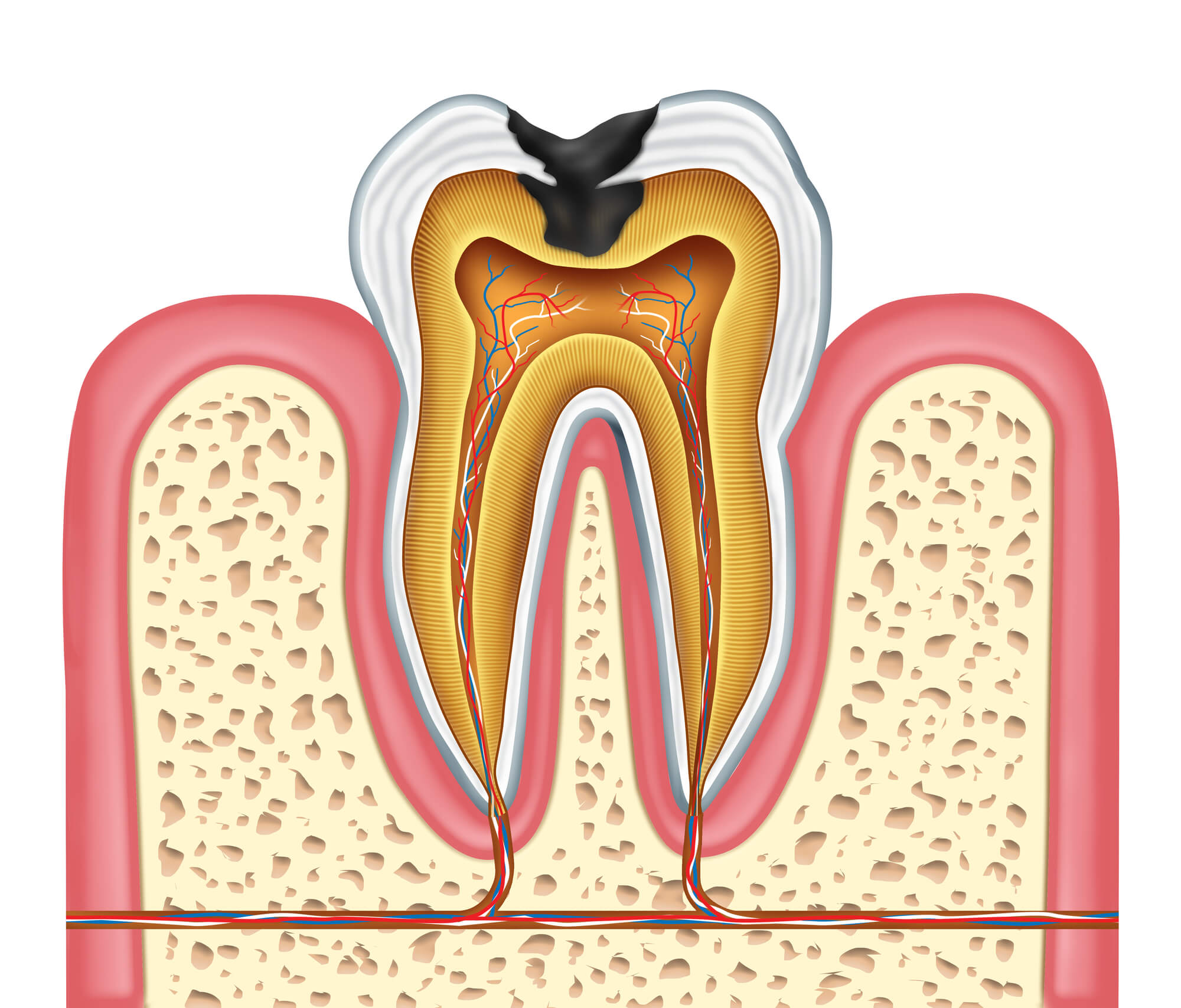 Dentist Fort Lauderdale