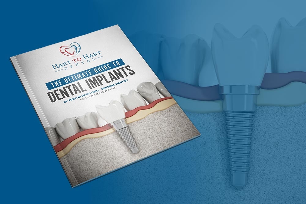 The Ultimate Guide to Dental Implants Fort Lauderdale by Hart to Hart Dental